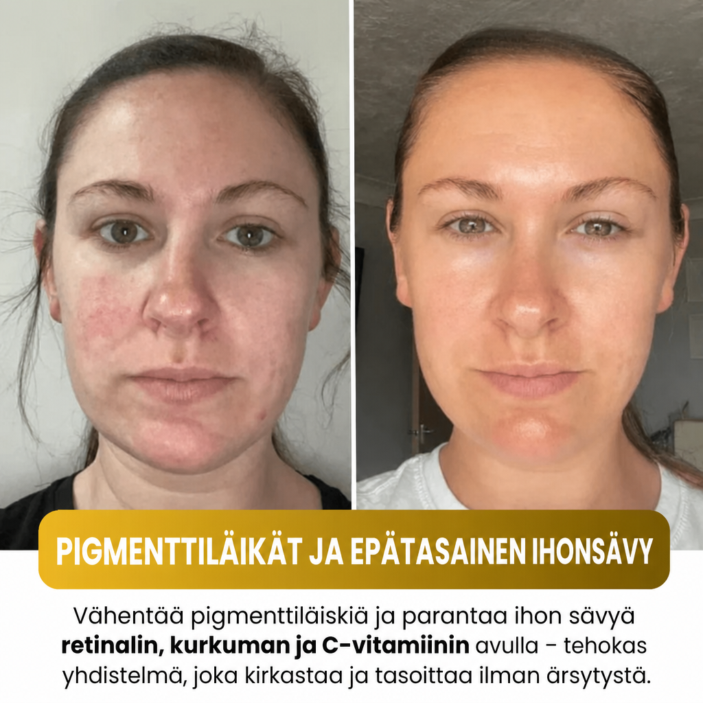 Guméa – Korealainen kasvonaamio kurkumalla ja kollageenilla
