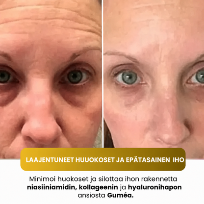 Guméa – Korealainen kasvonaamio kurkumalla ja kollageenilla